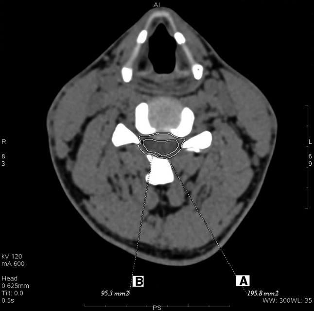 Fig. 1