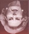 Fig 15