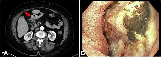 Figure 1