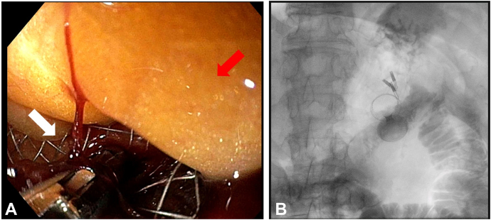 Figure 3