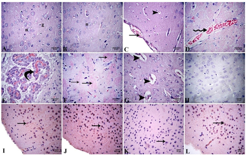 Alhagi Maurorum Ethanolic Extract Rescues Hepato-neurotoxicity And 