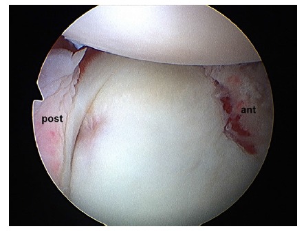 Fig. (3)