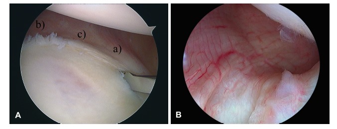 Fig. (1)