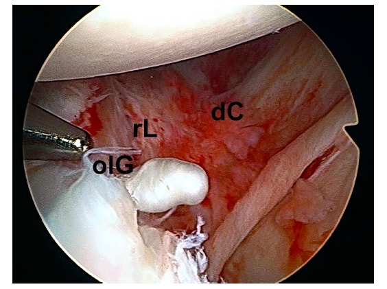 Fig. (2)