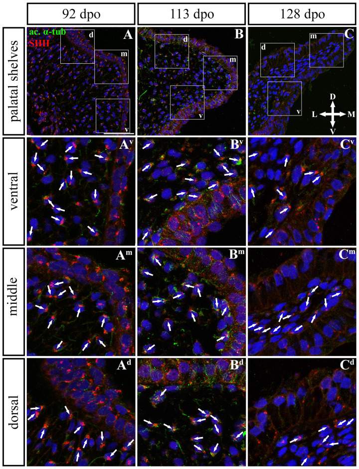 FIGURE 11