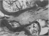 133