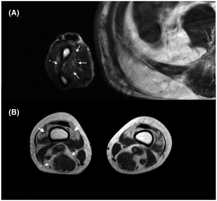 FIGURE 4