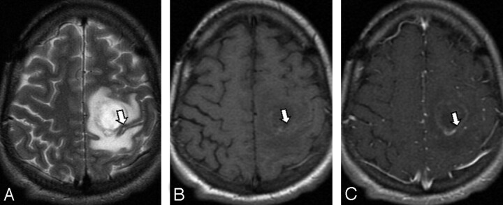 Fig 2.