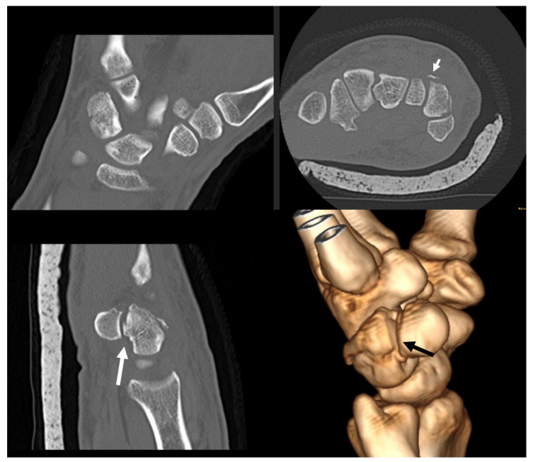 Fig. (2)