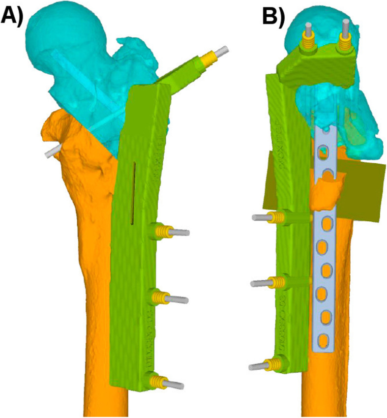 Fig. 4