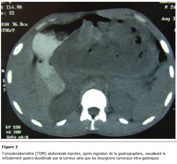 Figure 2: