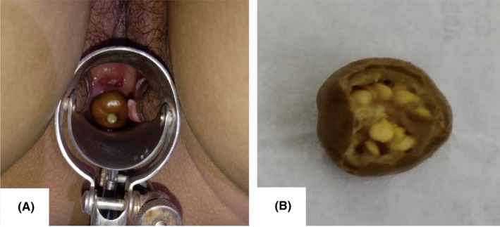 FIGURE 1
