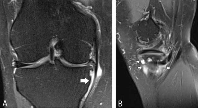 Figure 26