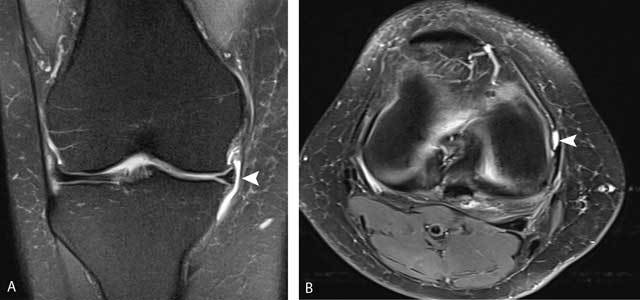 Figure 27