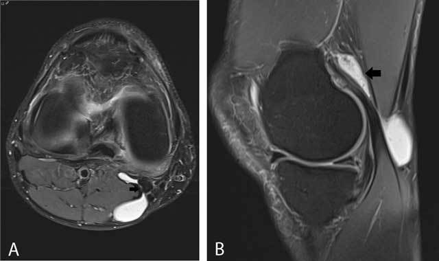 Figure 23