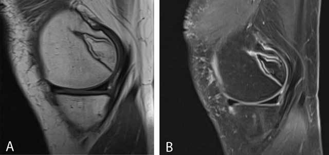 Figure 21