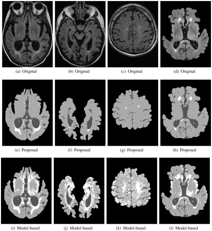 Fig. 15