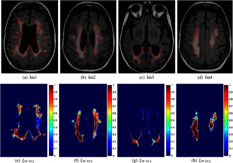 Fig. 13