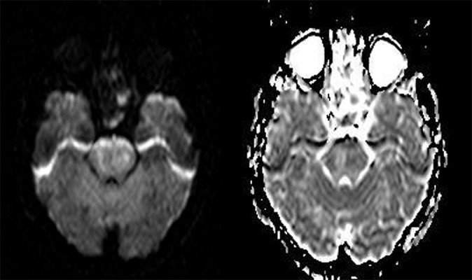 Figure 4A,B.