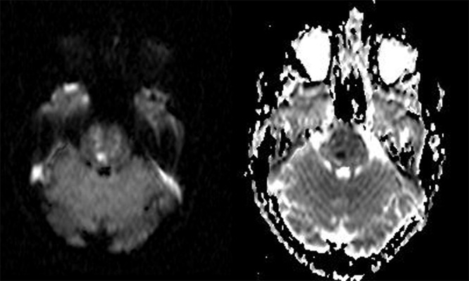 Figure 2A,B.