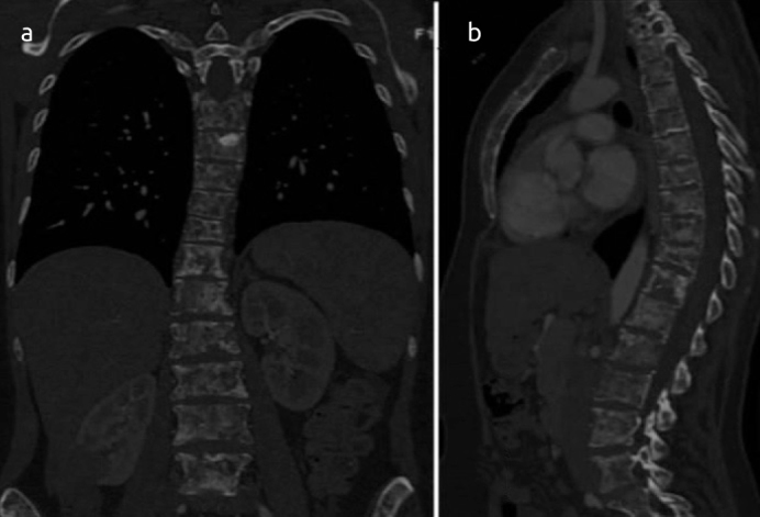 Figure 2. a, b