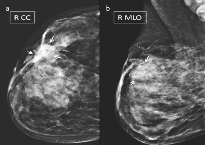 Figure 1. a, b