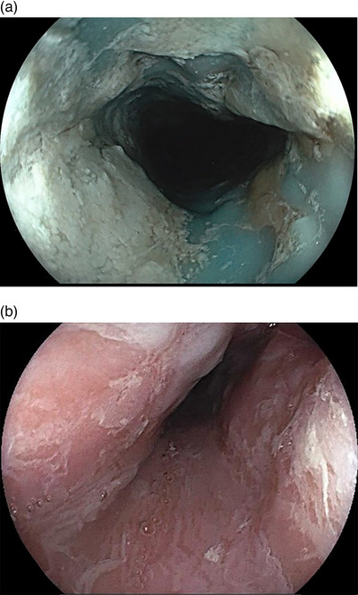 FIGURE 3