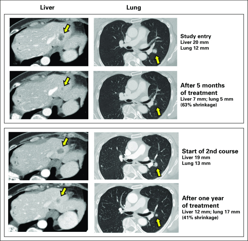 Fig 1.