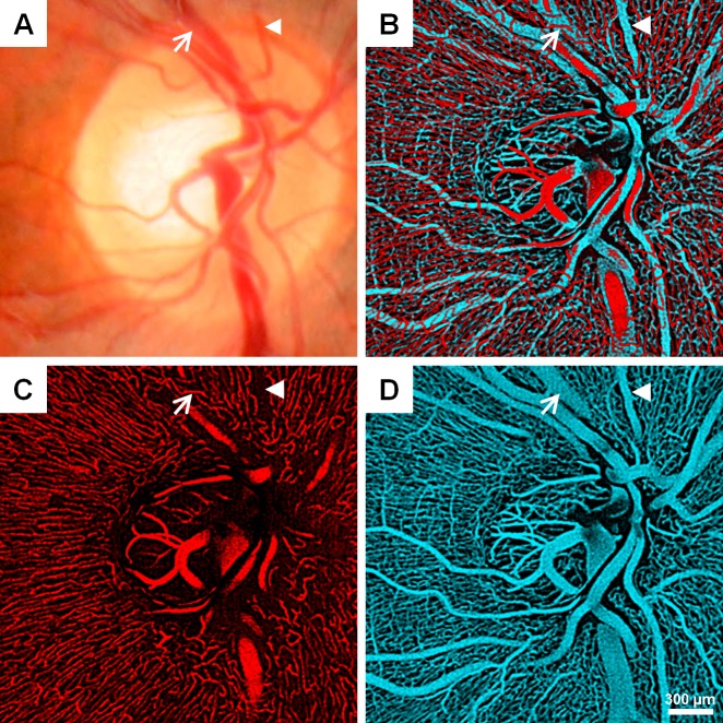 Fig 2