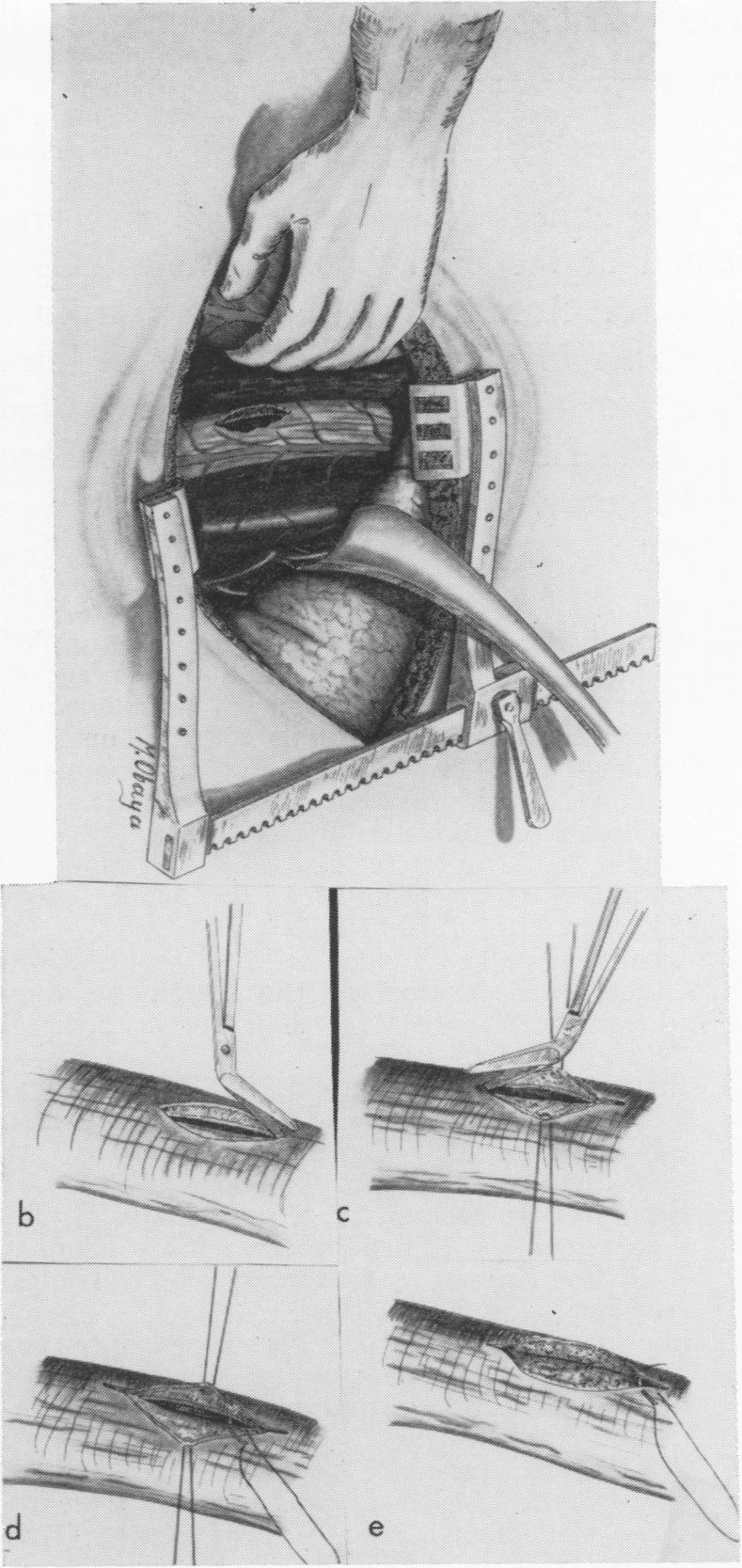 Fig. 4A.