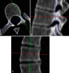 Fig. 1A–C