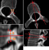 Fig. 2A–D