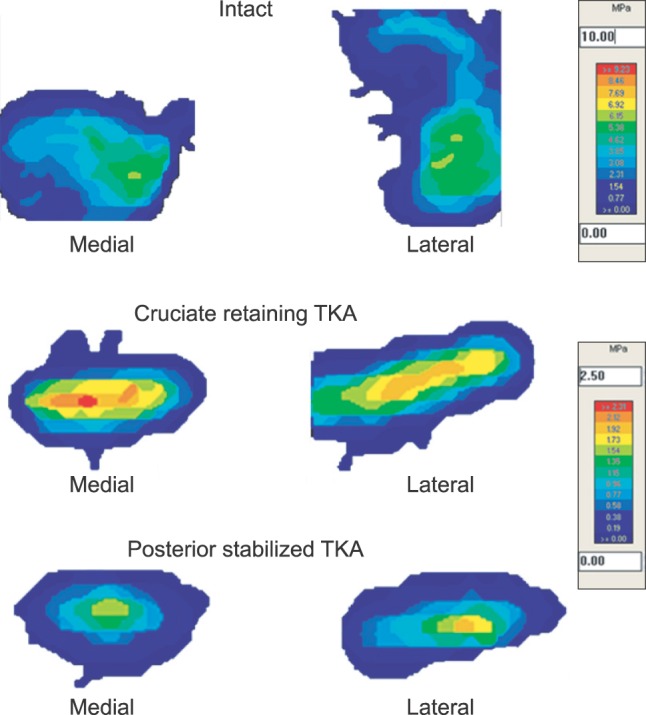 Biomechanics of Hyperflexion and Kneeling before and after Total Knee ...