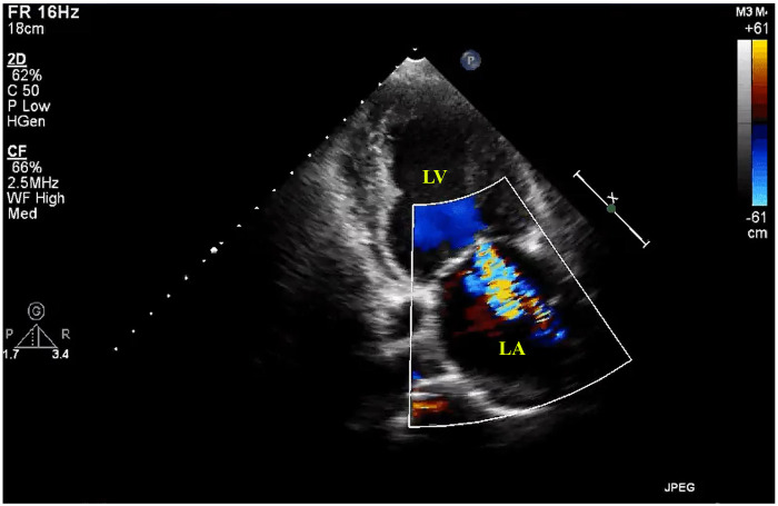 Figure 4