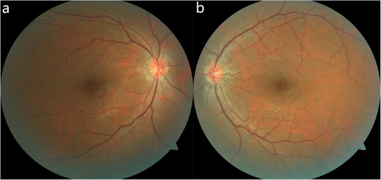 Fig. 2