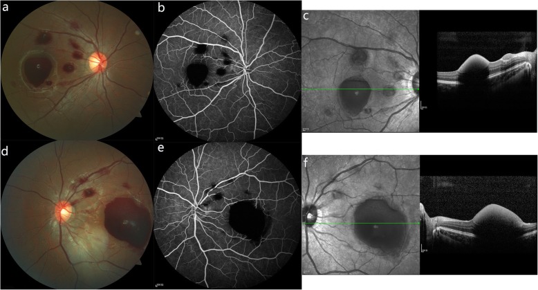 Fig. 1