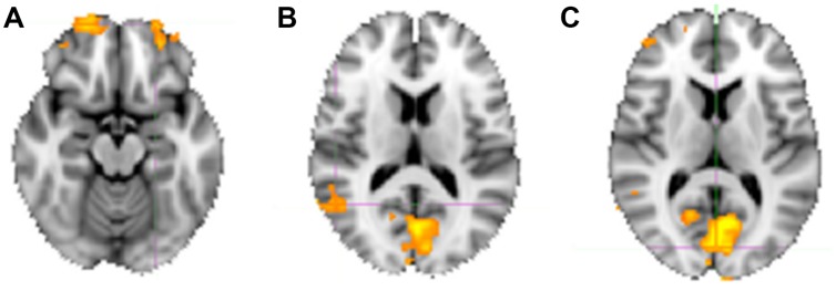 FIGURE 6