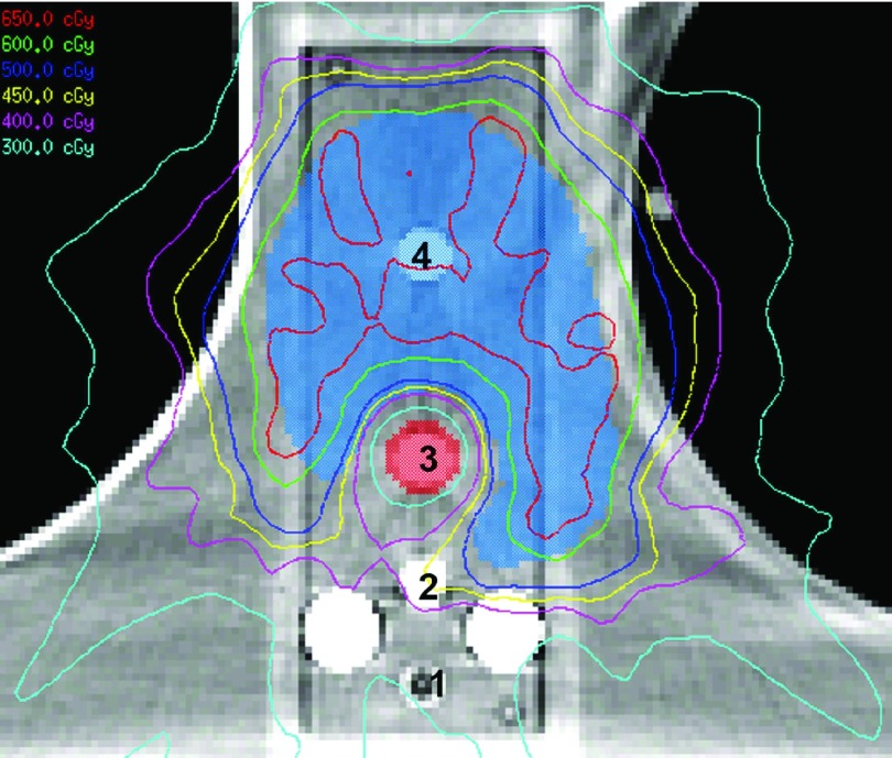 FIG. 3.