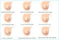 Figure 10