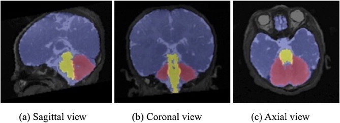 Fig. 2