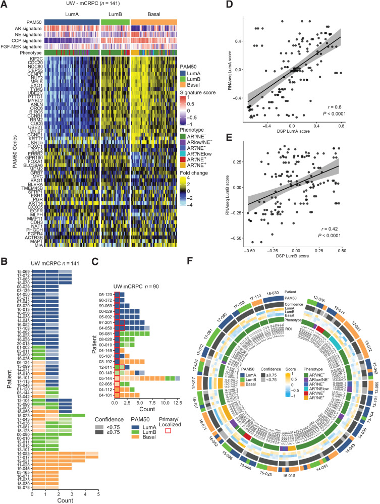 Figure 3. Inter- and intratumor heterogeneity of PAM50 classification in mCRPC. A, PAM50 classification partitions mCRPC tumors from the University of Washington rapid autopsy cohort into LumA, LumB, and Basal subtypes. Fold difference scale reflects mean-centered log2 FPKM values from RNAseq. Molecular signature scores and phenotypes shown at the top of plot and colored according to legends at the right side. B and C, RNAseq-based PAM50 classifications of multiple tumors from patients with mCRPC. Tumor counts are the number of tumors evaluated per individual patient. Colors reflect PAM50 classification and shading reflects the confidence of the PAM50 allocation based on the output of the PAM50 algorithm. D and E, Scatterplot of RNAseq-based PAM50 classification and digital spatial profiling (DSP) PAM50 classification from the same metastatic sample. Two-sided test for association using Pearson's correlation coefficient, r; P value shown on plots. F, Overall concordance and discordance of PAM50 tumor classifications shown by individual ROIs. Outer circle shows PAM50 classification in each ROI within and between individual ROIs, second circle shows confidence level of PAM50 classification, individual tumors and individual patients. Inner circle shows tumor phenotype classification by AR/NE gene expression status.