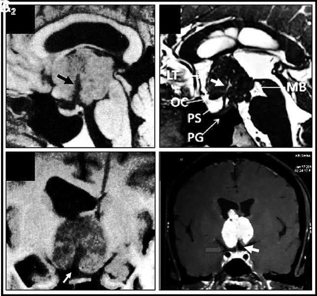 FIG 4.