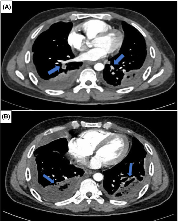 FIGURE 2