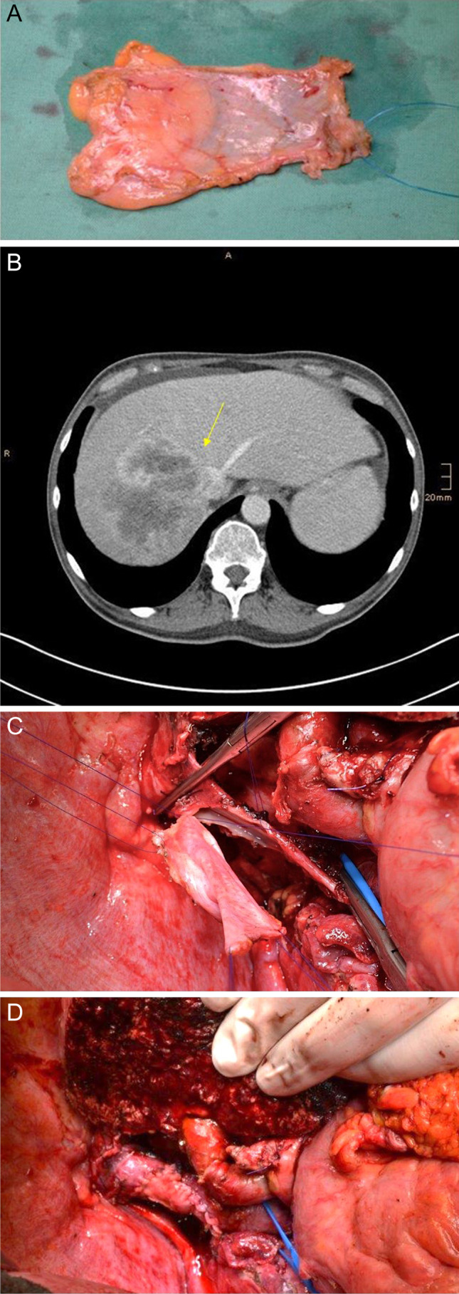 Fig. 8