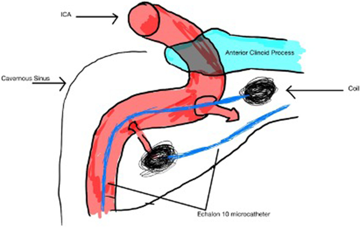 Figure 11