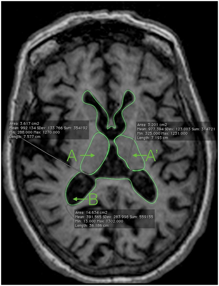 FIGURE 1