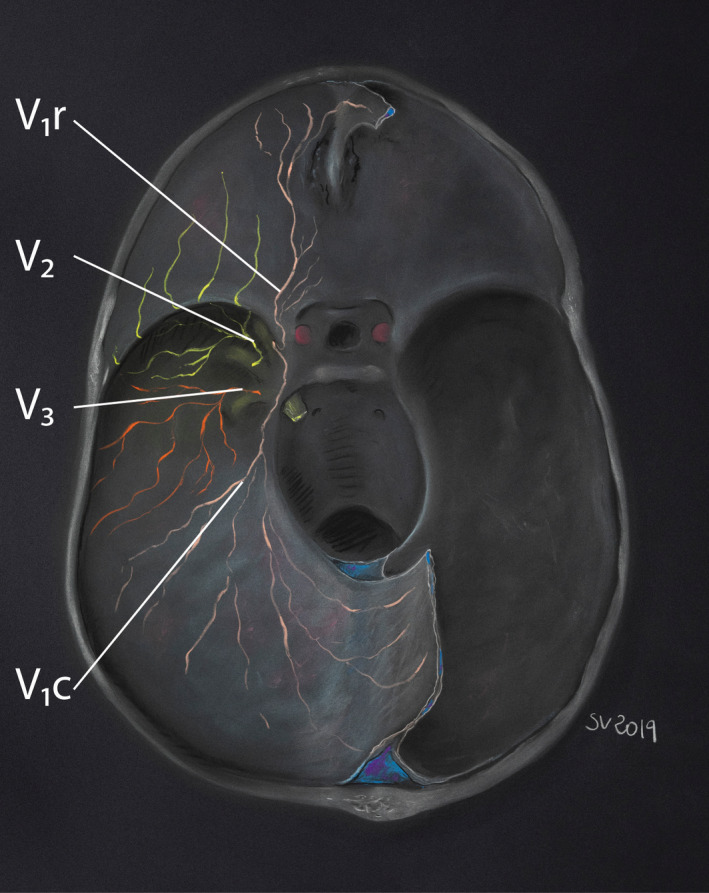 FIGURE 2