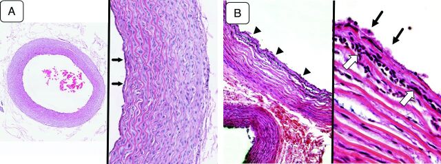 Fig 3.