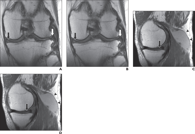 Fig. 4—