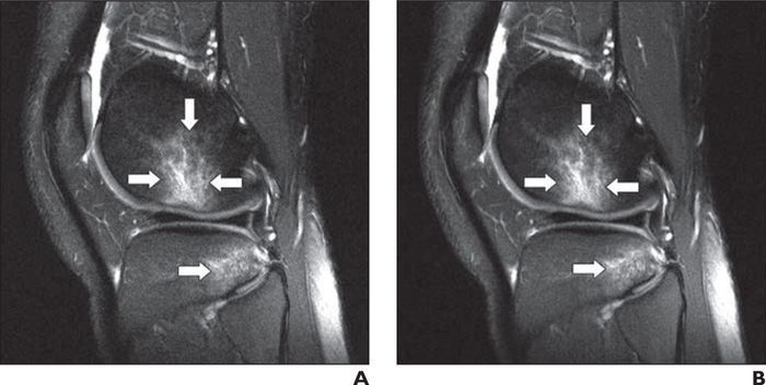 Fig. 5—